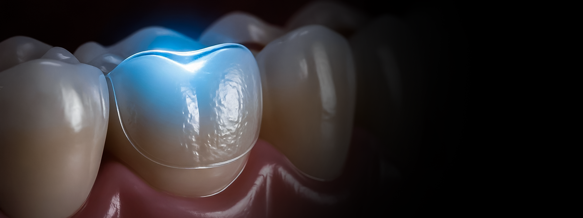 DENTÍSTICA RESTAURADORA