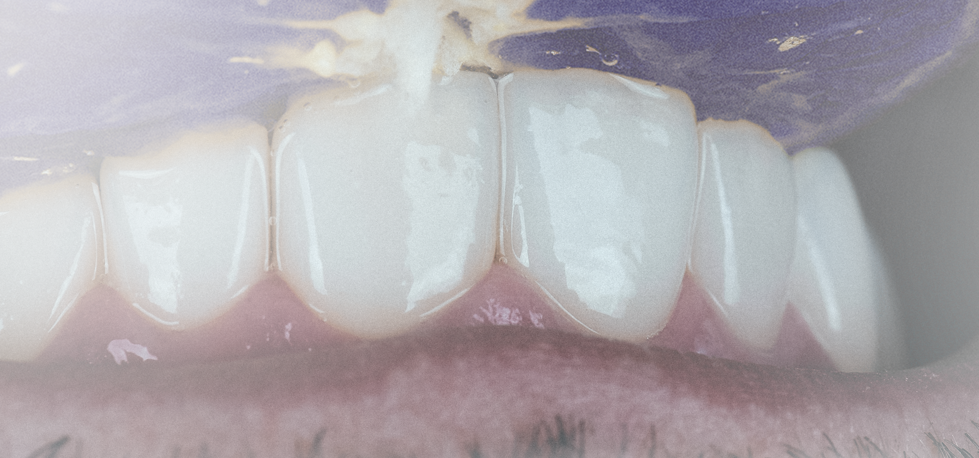 DENTÍSTICA RESTAURADORA